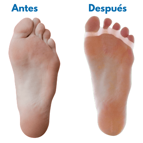 Separador de Dedos de Silicona – Alivio, Alineación y Bienestar para tus Pies - Nexos Vital